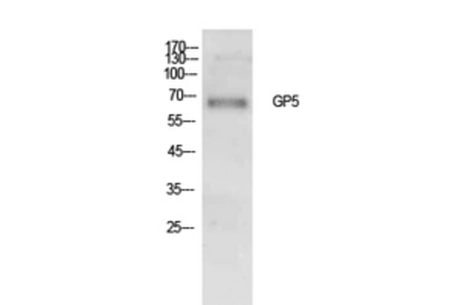 Western Blot - Anti-GP5 Antibody (C30354) - Antibodies.com
