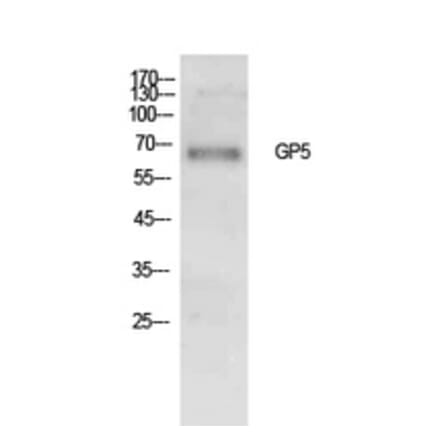 Western Blot - Anti-GP5 Antibody (C30354) - Antibodies.com