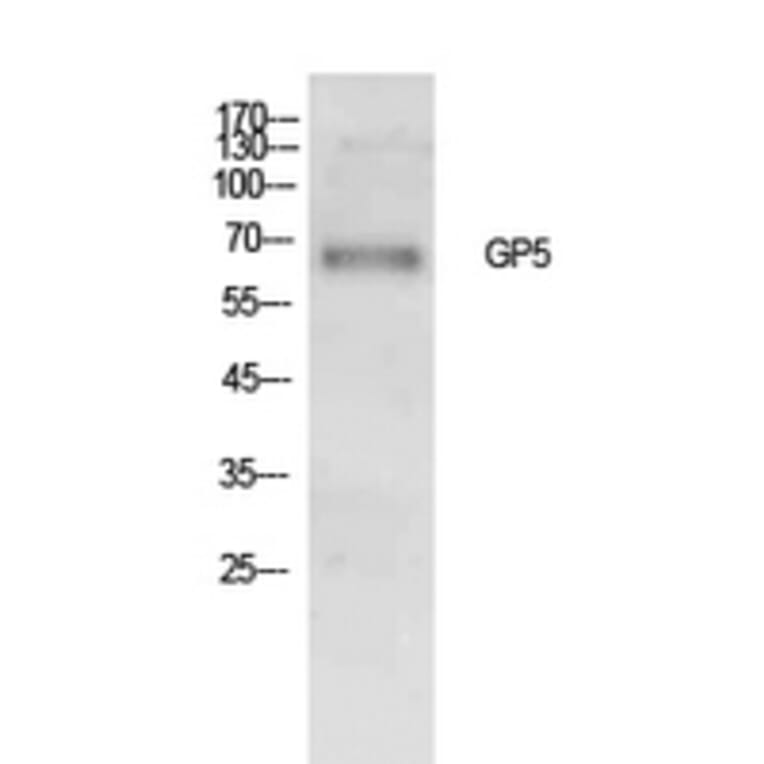 Western Blot - Anti-GP5 Antibody (C30354) - Antibodies.com