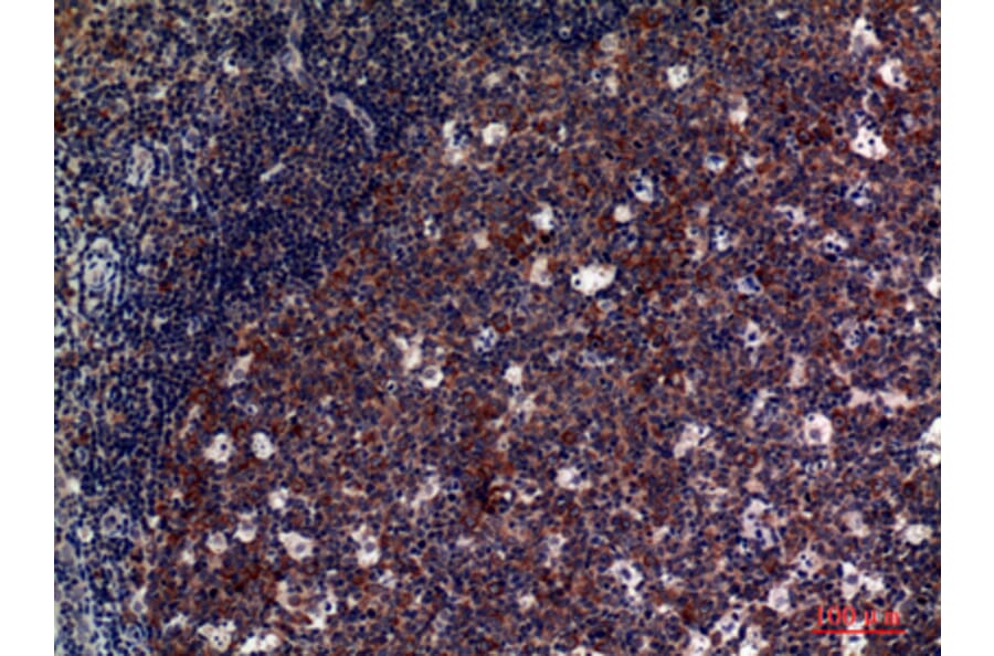 Immunohistochemistry - Anti-GP5 Antibody (C30354) - Antibodies.com