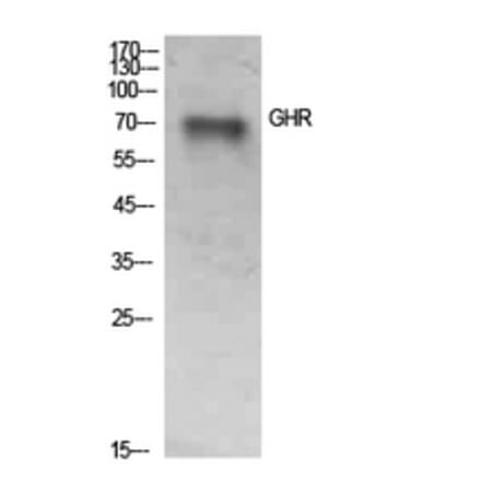 Western Blot - Anti-GHR Antibody (C30274) - Antibodies.com