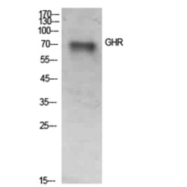 Western Blot - Anti-GHR Antibody (C30274) - Antibodies.com