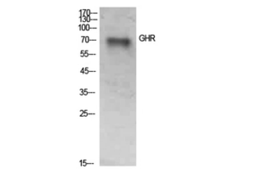 Western Blot - Anti-GHR Antibody (C30274) - Antibodies.com