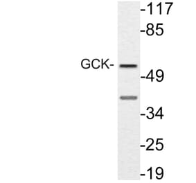 Western Blot - Anti-GCK Antibody (R12-2155) - Antibodies.com
