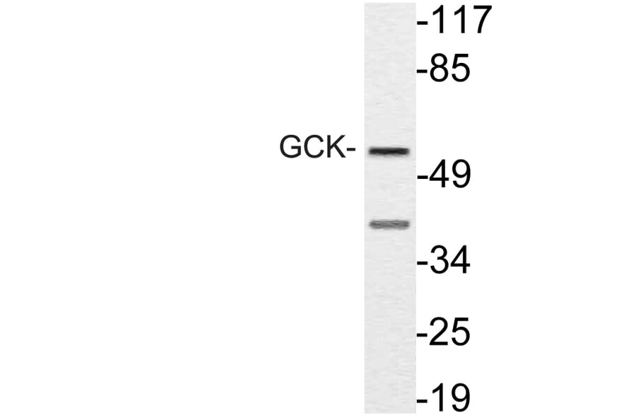 Western Blot - Anti-GCK Antibody (R12-2155) - Antibodies.com