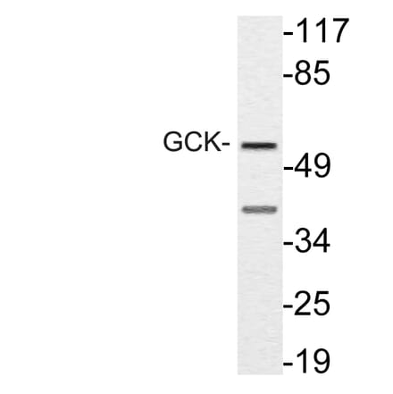 Western Blot - Anti-GCK Antibody (R12-2155) - Antibodies.com