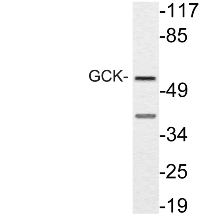 Western Blot - Anti-GCK Antibody (R12-2155) - Antibodies.com