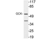 Western Blot - Anti-GCK Antibody (R12-2155) - Antibodies.com