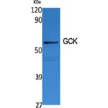 Western Blot - Anti-GCK Antibody (R12-2155) - Antibodies.com