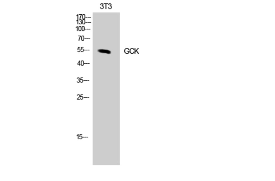 Western Blot - Anti-GCK Antibody (R12-2155) - Antibodies.com