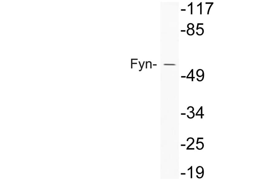 Western Blot - Anti-Fyn Antibody (R12-2148) - Antibodies.com