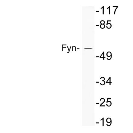 Western Blot - Anti-Fyn Antibody (R12-2148) - Antibodies.com