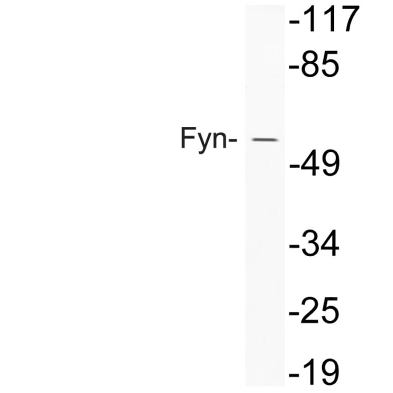 Western Blot - Anti-Fyn Antibody (R12-2148) - Antibodies.com