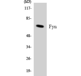 Western Blot - Anti-Fyn Antibody (R12-2781) - Antibodies.com