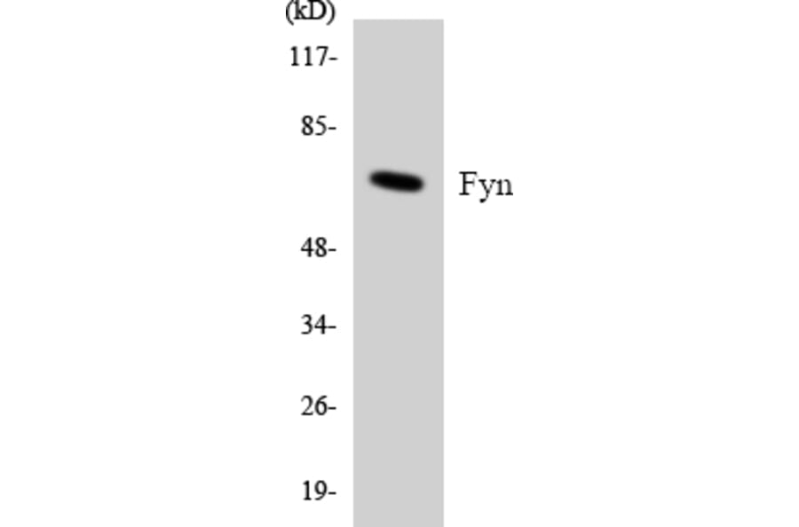 Western Blot - Anti-Fyn Antibody (R12-2781) - Antibodies.com