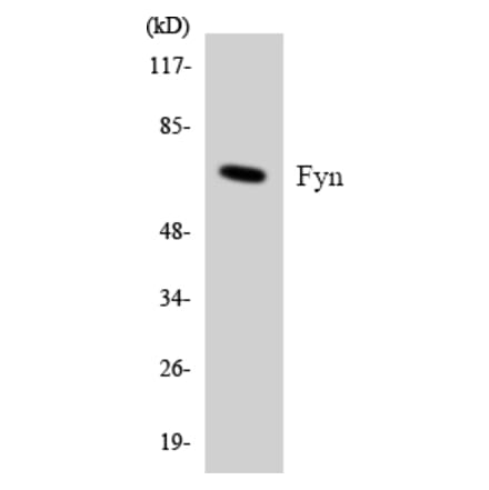 Western Blot - Anti-Fyn Antibody (R12-2781) - Antibodies.com