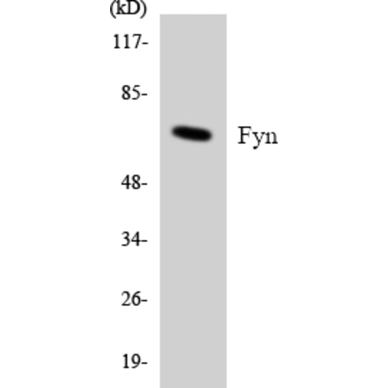 Western Blot - Anti-Fyn Antibody (R12-2781) - Antibodies.com