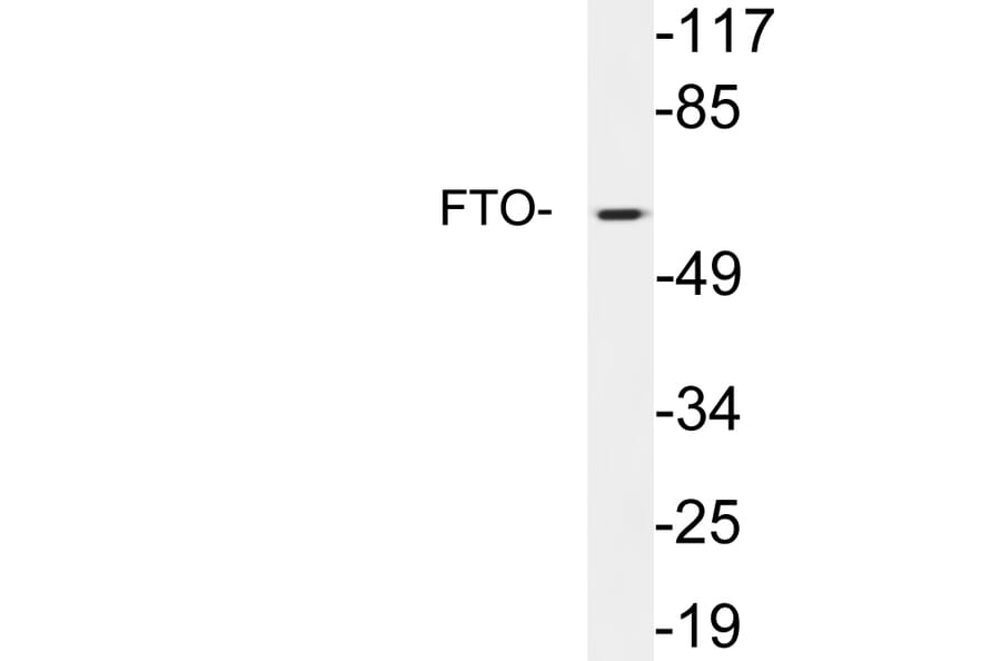 Western Blot - Anti-FTO Antibody (R12-2146) - Antibodies.com
