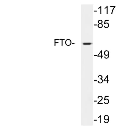 Western Blot - Anti-FTO Antibody (R12-2146) - Antibodies.com