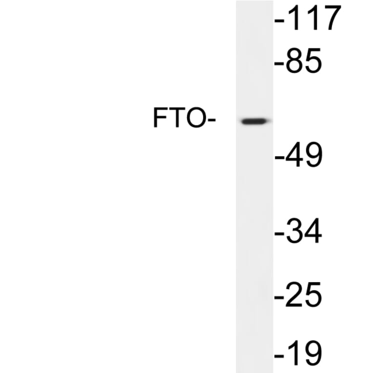 Western Blot - Anti-FTO Antibody (R12-2146) - Antibodies.com