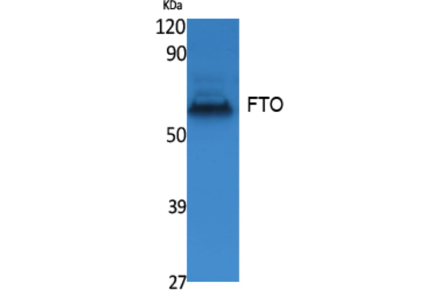 Western Blot - Anti-FTO Antibody (R12-2146) - Antibodies.com