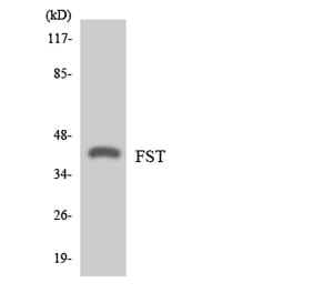 Western Blot - Anti-FST Antibody (R12-2780) - Antibodies.com