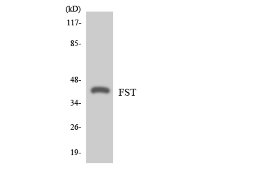 Western Blot - Anti-FST Antibody (R12-2780) - Antibodies.com