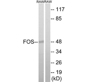 Western Blot - Anti-FOS Antibody (B8226) - Antibodies.com