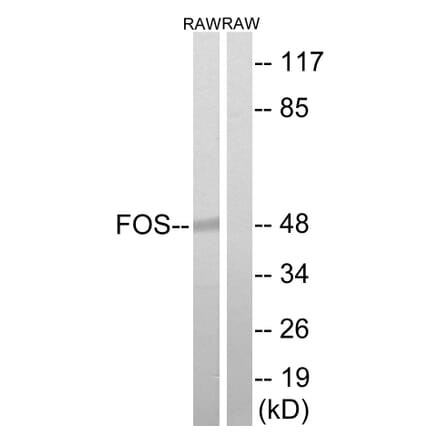 Western Blot - Anti-FOS Antibody (B8226) - Antibodies.com