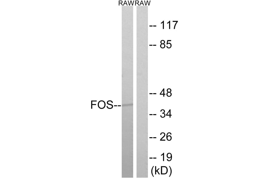 Western Blot - Anti-FOS Antibody (B8212) - Antibodies.com