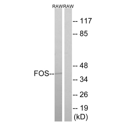 Western Blot - Anti-FOS Antibody (B8212) - Antibodies.com