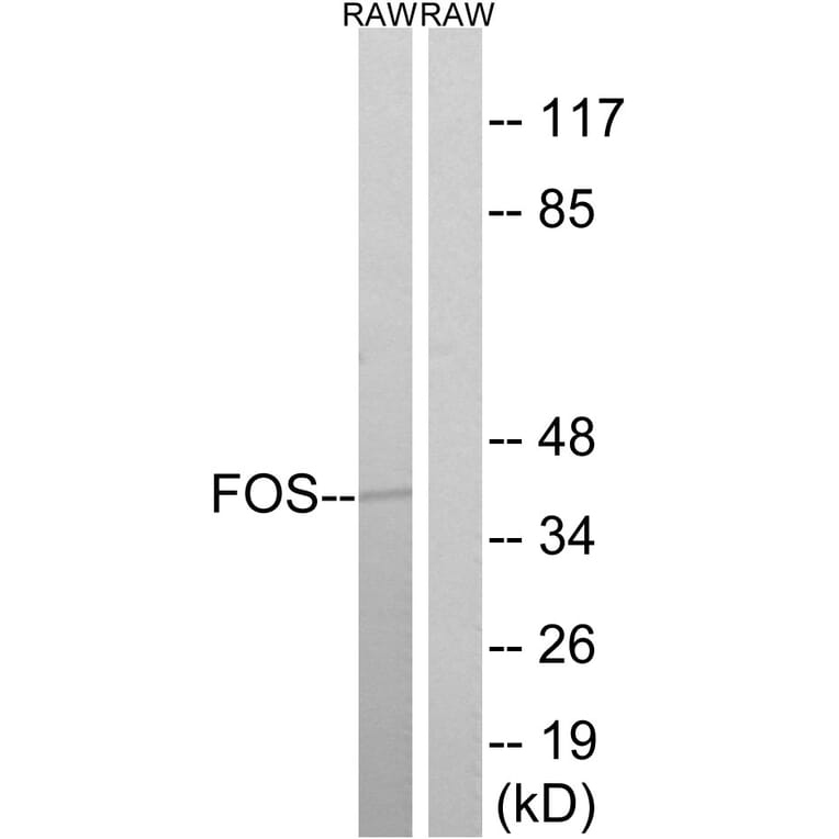 Western Blot - Anti-FOS Antibody (B8212) - Antibodies.com