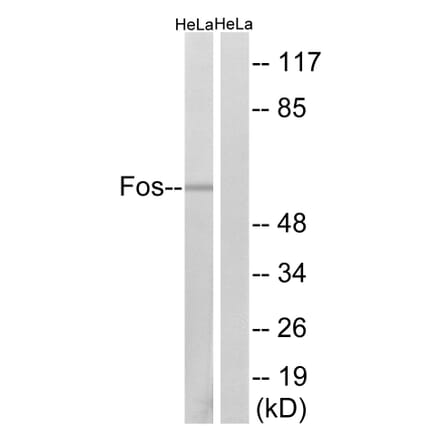Western Blot - Anti-Fos Antibody (B8344) - Antibodies.com