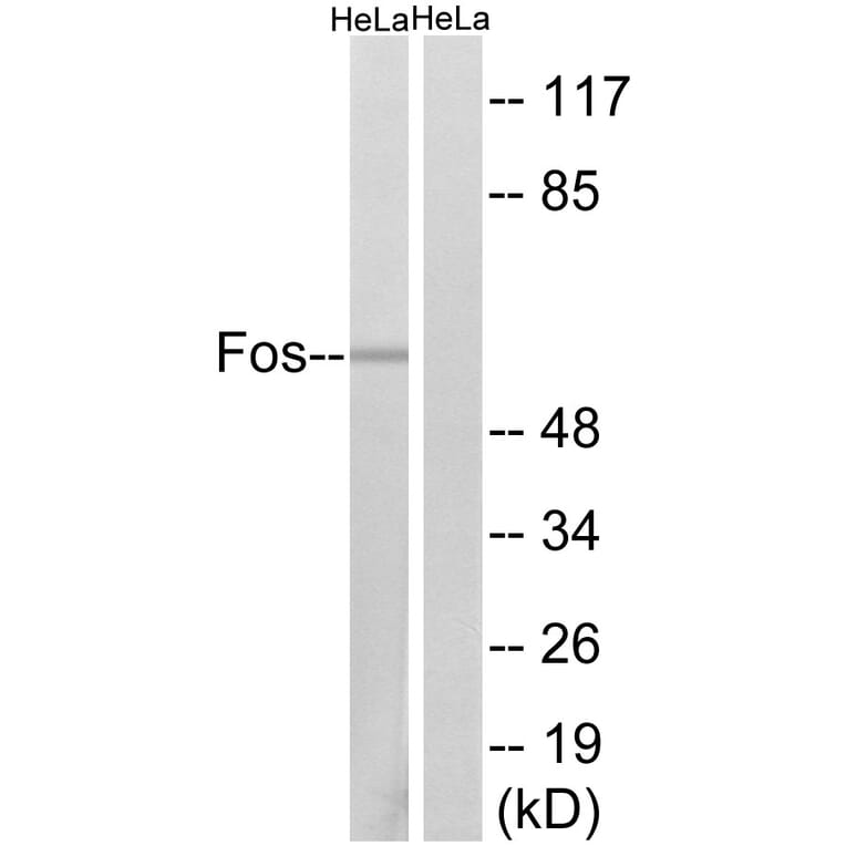 Western Blot - Anti-Fos Antibody (B8344) - Antibodies.com