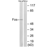 Western Blot - Anti-Fos Antibody (B8344) - Antibodies.com
