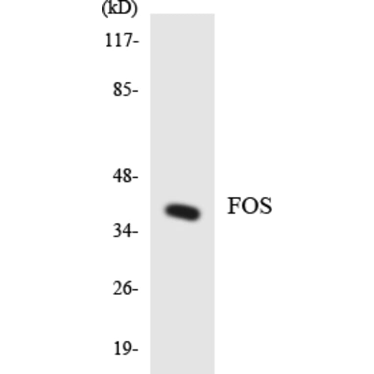 Western Blot - Anti-FOS Antibody (R12-2772) - Antibodies.com