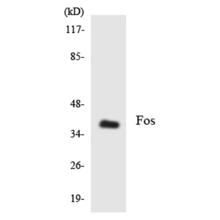 Western Blot - Anti-Fos Antibody (R12-2773) - Antibodies.com