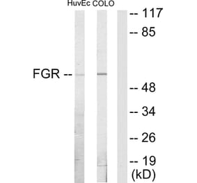 Western Blot - Anti-FGR Antibody (C10321) - Antibodies.com