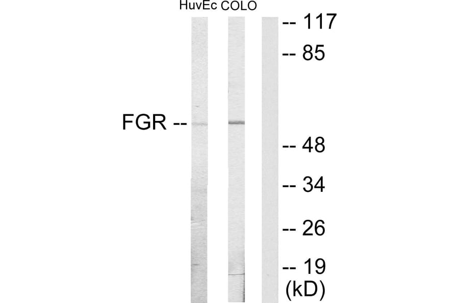 Western Blot - Anti-FGR Antibody (C10321) - Antibodies.com