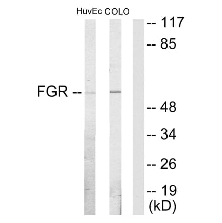 Western Blot - Anti-FGR Antibody (C10321) - Antibodies.com