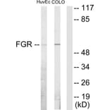 Western Blot - Anti-FGR Antibody (C10321) - Antibodies.com