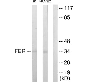 Western Blot - Anti-FER Antibody (C10391) - Antibodies.com