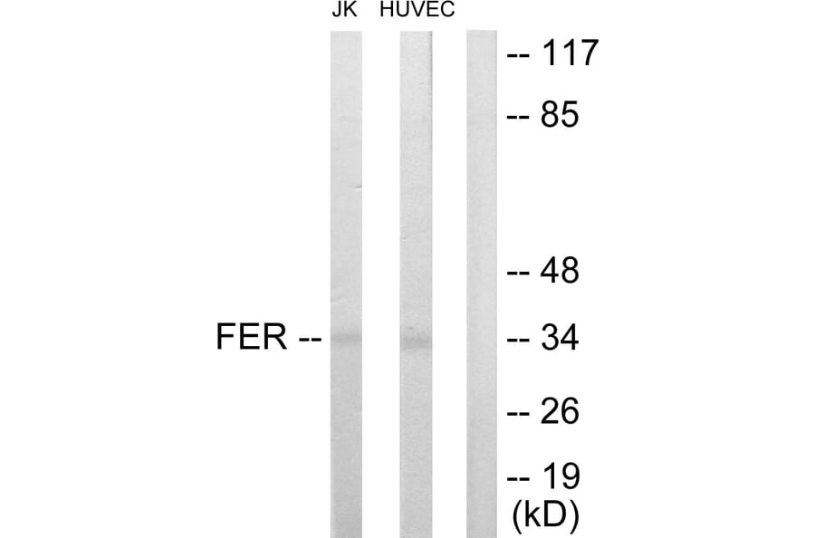 Western Blot - Anti-FER Antibody (C10391) - Antibodies.com