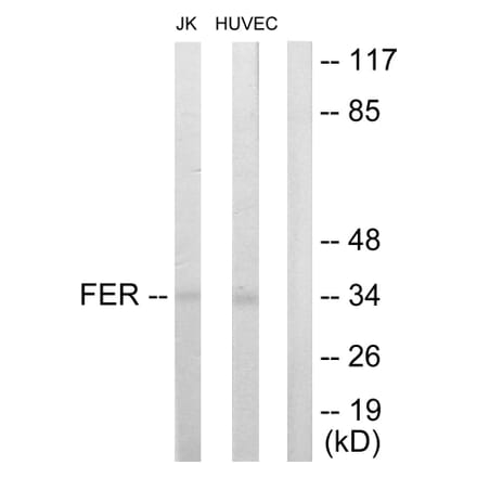 Western Blot - Anti-FER Antibody (C10391) - Antibodies.com