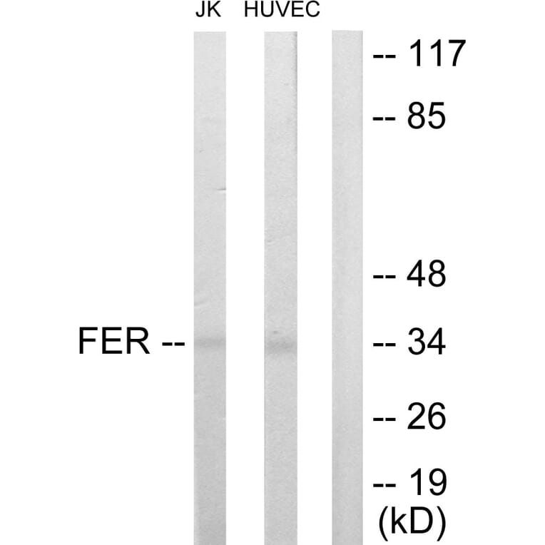 Western Blot - Anti-FER Antibody (C10391) - Antibodies.com