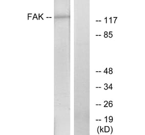 Western Blot - Anti-FAK Antibody (B7082) - Antibodies.com