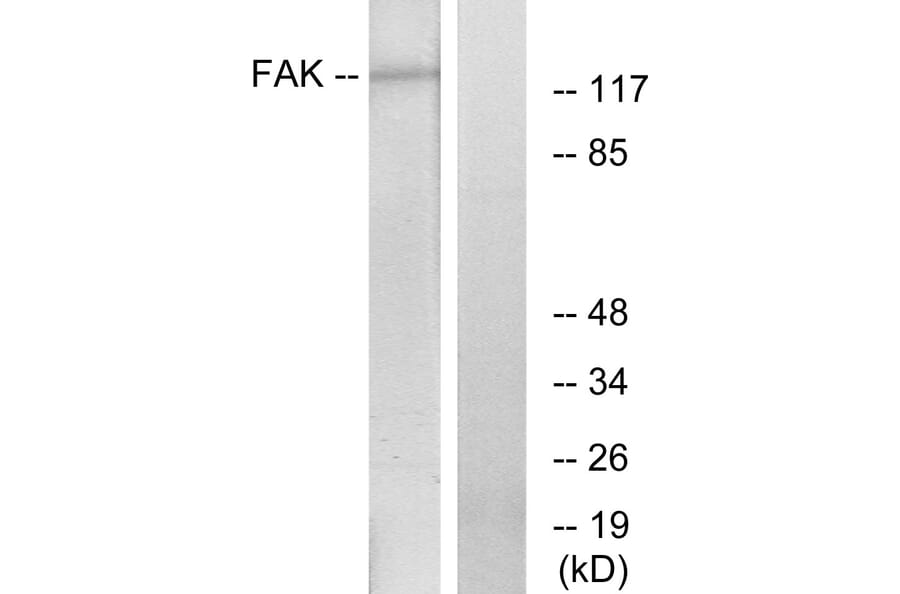Western Blot - Anti-FAK Antibody (B7082) - Antibodies.com