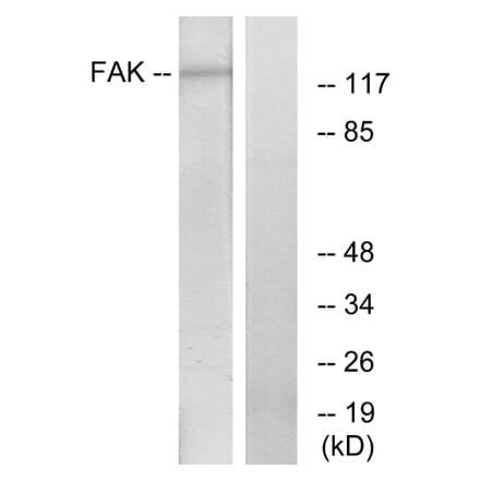 Western Blot - Anti-FAK Antibody (B7082) - Antibodies.com