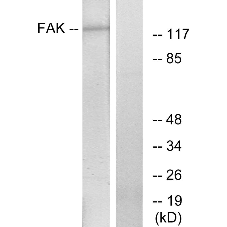 Western Blot - Anti-FAK Antibody (B7082) - Antibodies.com