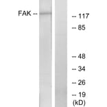 Western Blot - Anti-FAK Antibody (B7082) - Antibodies.com